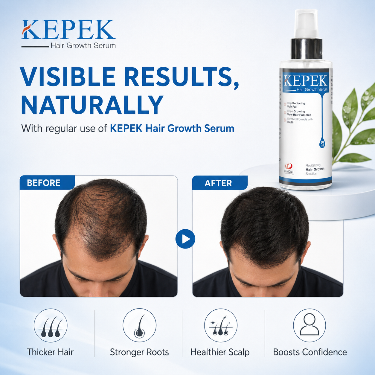 KEPEK Hair Growth Serum | Turkish Formula for Hair Loss & Thinning | DeMont